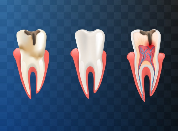 Dentist vs. Orthodontist